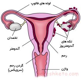 بیماری های شایع زنان از نظر متخصص زنان در شیراز