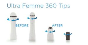 روش ULTRA FEMME 360 چیست؟
